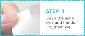 Clean the acne area and hands. Dry them well