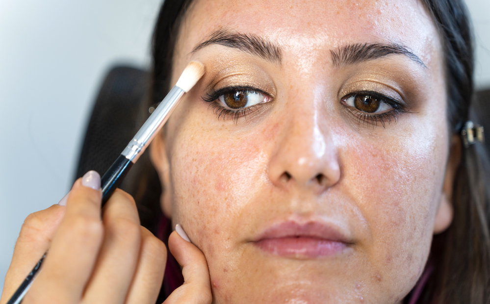 girl-with-acne-applying-makeup