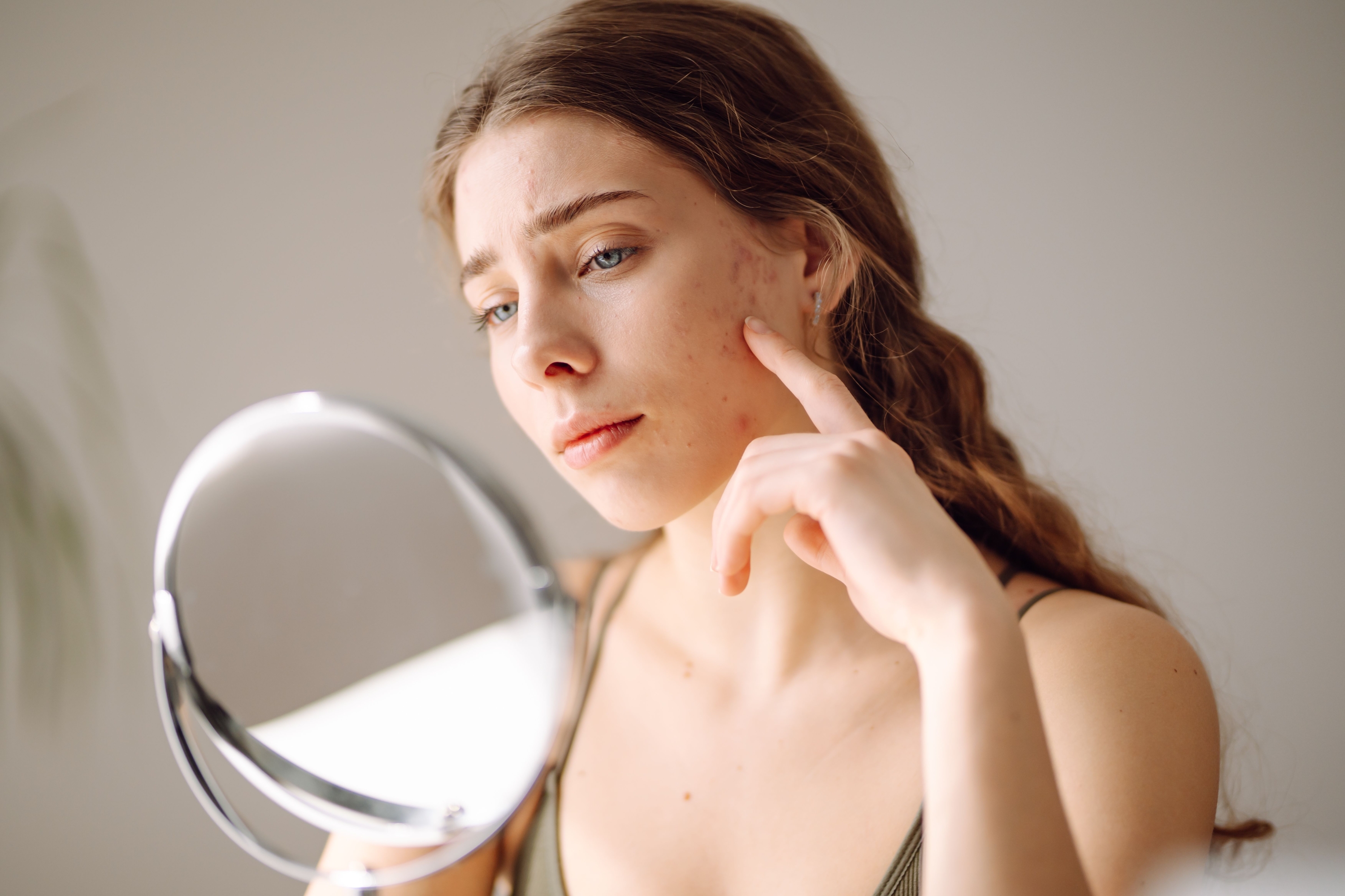 woman–with-mirror-in-hand-pimples-facial-skin-problems