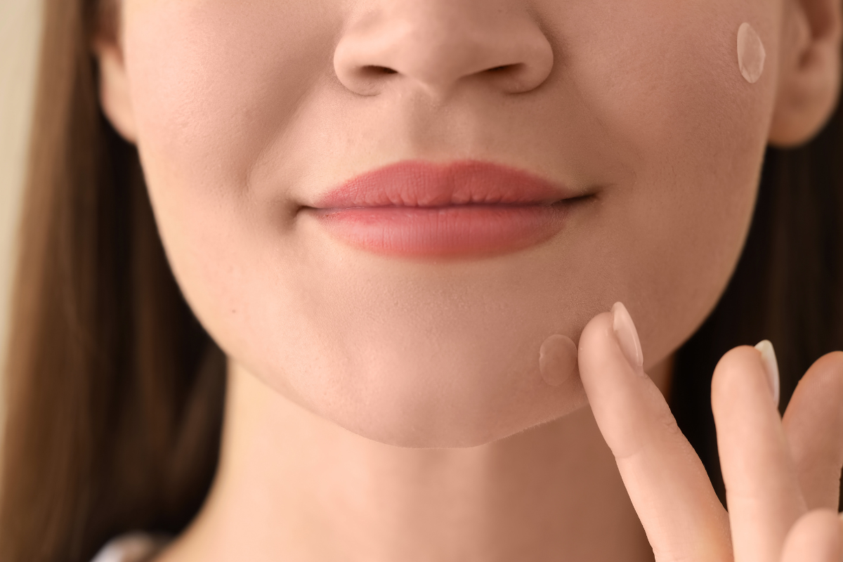 girl-touching-a-pimple-patch-on-her-face