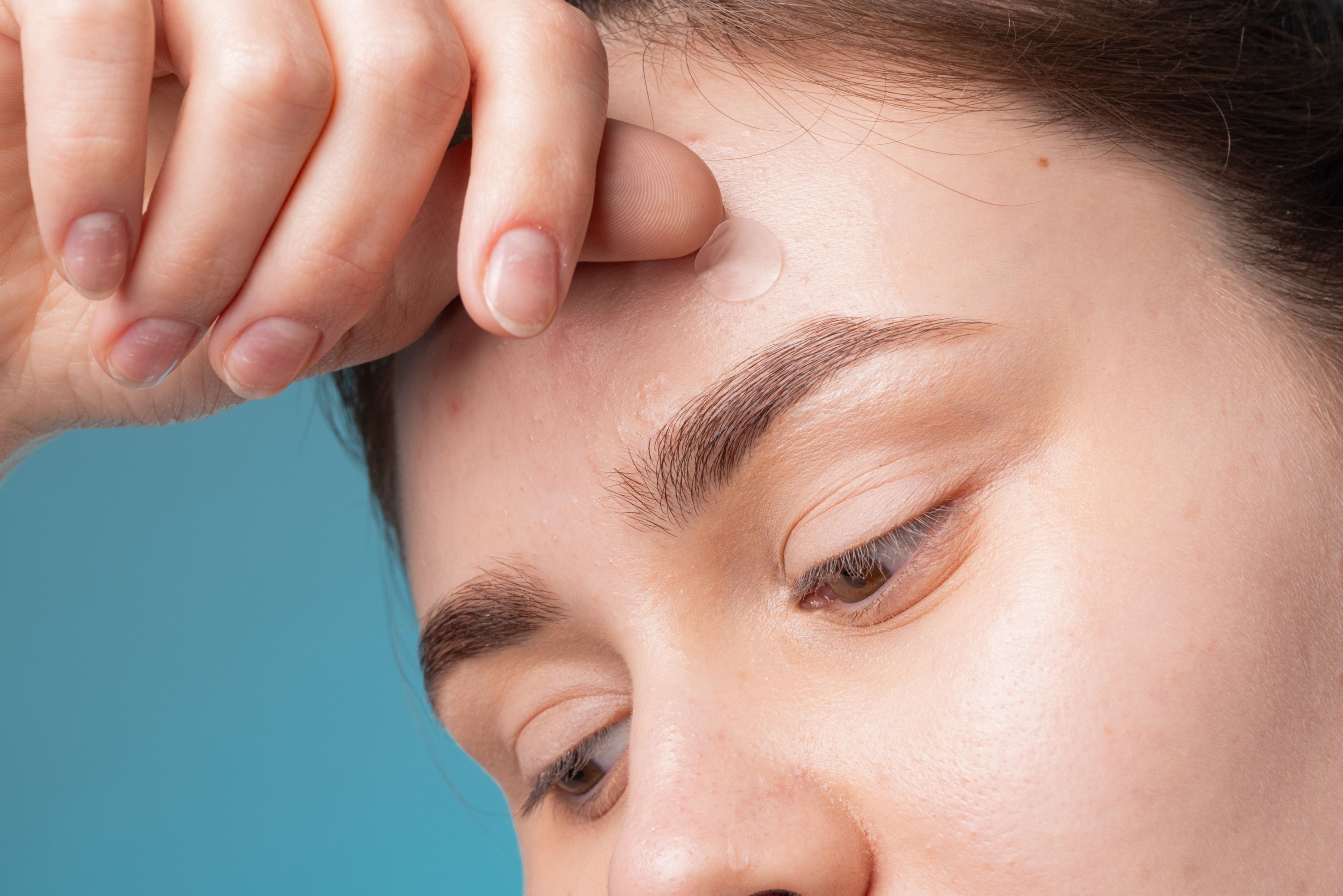 Girl-with-acne-stick-round-acne-patch-on-her-cheek.