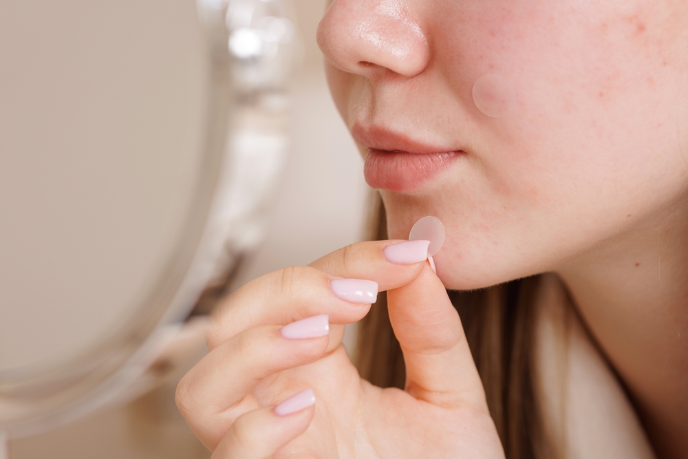 closeup-young-woman-applying-transparent-acne